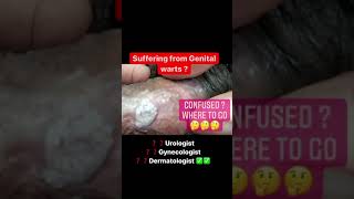 Genital Warts Treatment |Genital warts|genital warts men|hpv|sexually transmitted disease #shorts