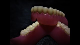 Total Protezlerde Lab.Remounting Tesfiye ve Polisaj-Complete Denture Lab Rem Finisihing and Polising