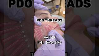 PDO threading with Dr.Kaado! #threads #pdothread #pdo #threading #face #aesthetics #antiaging #med