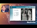 Lecture: Patient Selection and Medical Optimization in Adult Spinal Deformity