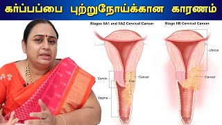 கர்ப்பப்பை வாய் புற்றுநோய் | Cervical cancer symptoms, causes and prevention Dr Buvaneswari | GBR