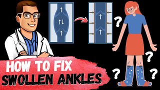 How to Get Rid of Swollen Ankles & Swollen Legs FAST [Causes & Fixes]