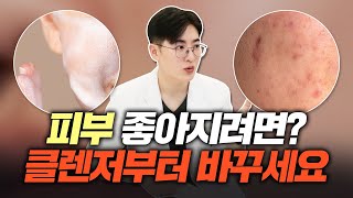 피부 좋아지려면? 당장 '클렌저'부터 바꾸세요.. | 올바른 세안법, 피부 타입 별 클렌저 추천