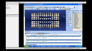 Dentrix training 6   Patient Chart