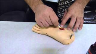 How to Apply Monsel's to a Large Wound