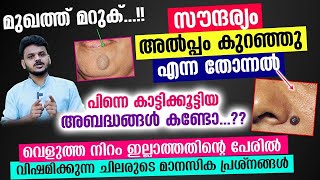 മുഖത്തെ 'മറുക് ' കാരണം സൗന്ദര്യം കുറഞ്ഞു എന്ന തോന്നൽ..!! മാനസിക പ്രശ്നങ്ങൾക്ക് കാരണമായി.| Psy Farhan