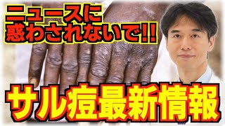 【サル痘】イタズラに煽る情報に注意！論文から紐解く症状・原因・対処法、ワクチンについて解説します！