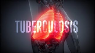 Global Tuberculosis Report-2019 (E)