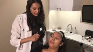 Chemical Peels - CLSC Education