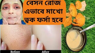 রোজ বেসন এই ভাবে মাখো ত্বক দুগুন ফর্সা করে কুঁচকে গেছে ত্বক কালো দাগ পিগমেন্ট মুছে যাবে/besanfacial