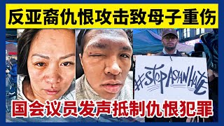 【纽约新闻】亚裔母子被骂“丑陋的亚洲人”！因反亚裔仇恨攻击受重伤 2023