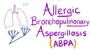Allergic Bronchopulmonary Aspergillosis (ABPA) - Asthma, Cough, Eosinophils - Lungs