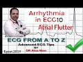 ECG from A to Z, intermediate level, Arrhythmia 10, Dr Alaa Nasr, 2019