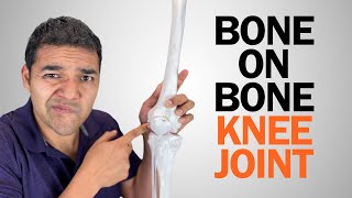 What Happened Inside Your Painful Bone On Bone Knee Joint?