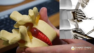 What Happens to your Spine in a Rear End Auto Accident