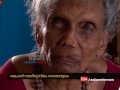 ആലപ്പുഴ നൂറനാട് കുഷ്ഠ രോഗ കേന്ദ്രത്തില്‍ അന്തെവസികള്‍ക്ക് നരക ജീവിതം