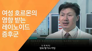 여성 호르몬의 영향 받는 레이노이드 증후군 - (2012.2.4_400회 방송)_건강의 위험신호, 수족냉증