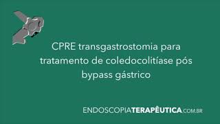 CPRE transgástrica em cirurgia bariátrica (bypass)