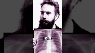 The Accidental Invention of the X-Ray🩻 #video #facts #history #lifehistory