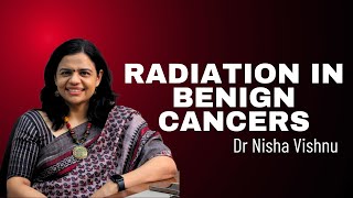 Radiation in Benign Cancers | Dr. Nisha Vishnu