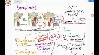 Osteomielitis : Patofisiologi, Radiologi (Xray), Tatalaksana, Komplikasi