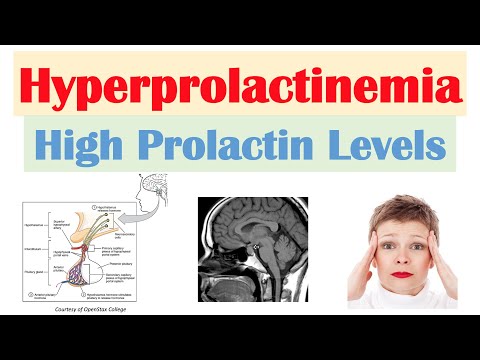 How does hyperthyroidism affect prolactin?