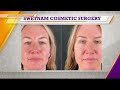 Swetnam Cosmetic Surgery on Good Day NWA