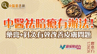 農本方特約：【中醫藥透視】暗瘡（嘉賓：恩禧醫療中醫診所 曾君慧醫師）