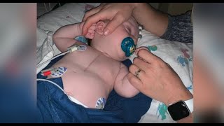 James' Heart Story