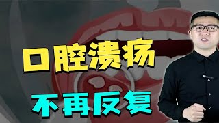 上火口腔溃疡反复长？中医分实火和虚火，看看你是哪一种？