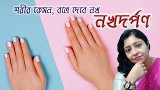 Know your health from your nails in bengali নখ বলে দেবে কেমন আছে শরীর