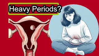 Understanding Menorrhagia: Normal vs. Excessive Menstrual Periods