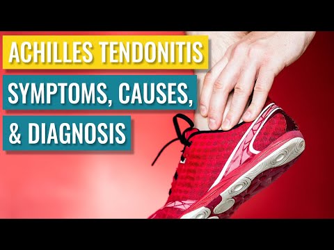 What triggers tendonitis?
