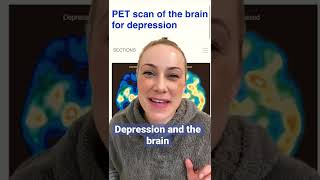 Can you see depression in the brain?