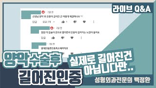 선생님 양악후 인중이 더 길어진건 어떻게 해결하나요?