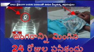 ఉంగరాన్ని మింగిన 24 రోజుల పసికందు | 24 Days Old Baby Swallows Ring | Kurnool | HMTV