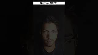 Before(Lallu) and After NEET(All India Topper)|Part 1🎯#motivation #neet2022