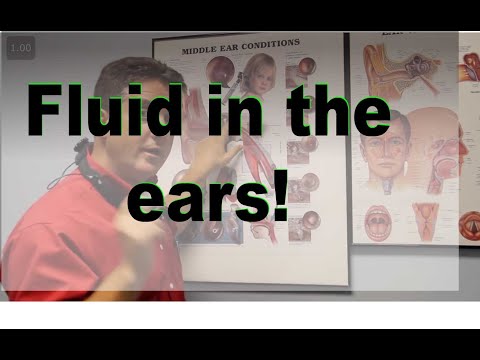 How do you get rid of fluid in mastoid air cells?
