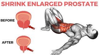 10 Minute Routine to Shrink Enlarged Prostate