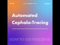 WEBCEPH Tutorial Shorts: Automated Cephalometric Tracing