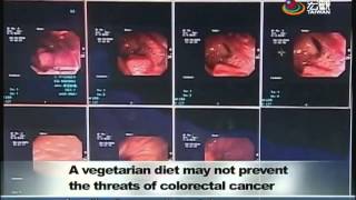 臨床發現 素食者也可能罹患大腸癌 Vegetarians equally susceptible to colorectal cancer—宏觀英語新聞