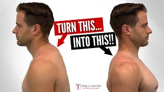 Fix Neck Hump FAST With These Home Exercises!