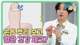 똑똑하게 혈관 건강 체크하는 법! 손톱 뿌리를 봐라?! MBN 210914 방송