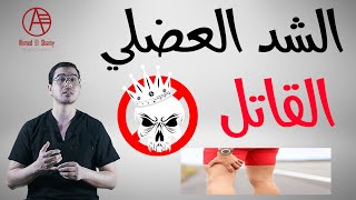 الشد العضلي القاتل | العرج المتقطع - Claudication Pain