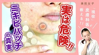 ニキビ パッチの真実！知っておきたい正しい使い方【皮膚科医が教える】