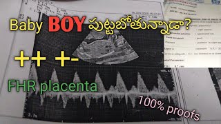 baby boy scan reports || మగ బిడ్డ మీ కడుపులో ఉంటే క్షణాల్లో తెలిసిపోతుంది #babyscanreport #tiffascan