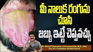 మీ నాలుక రంగును చూసి జబ్బు ఇట్టే చెప్పవచ్చు! What your tongue says about your health #healthtips