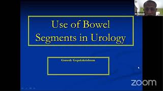 Use of Bowel Segments in Urology || Bladder Augmentation|| Gastrocystoplasty || Enterocystoplasty ||