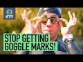 How To Stop Getting Goggle Eyes From Swimming!