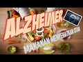 10 Makanan Menyehatkan Otak Mengurangi Risiko Penyakit Alzheimer